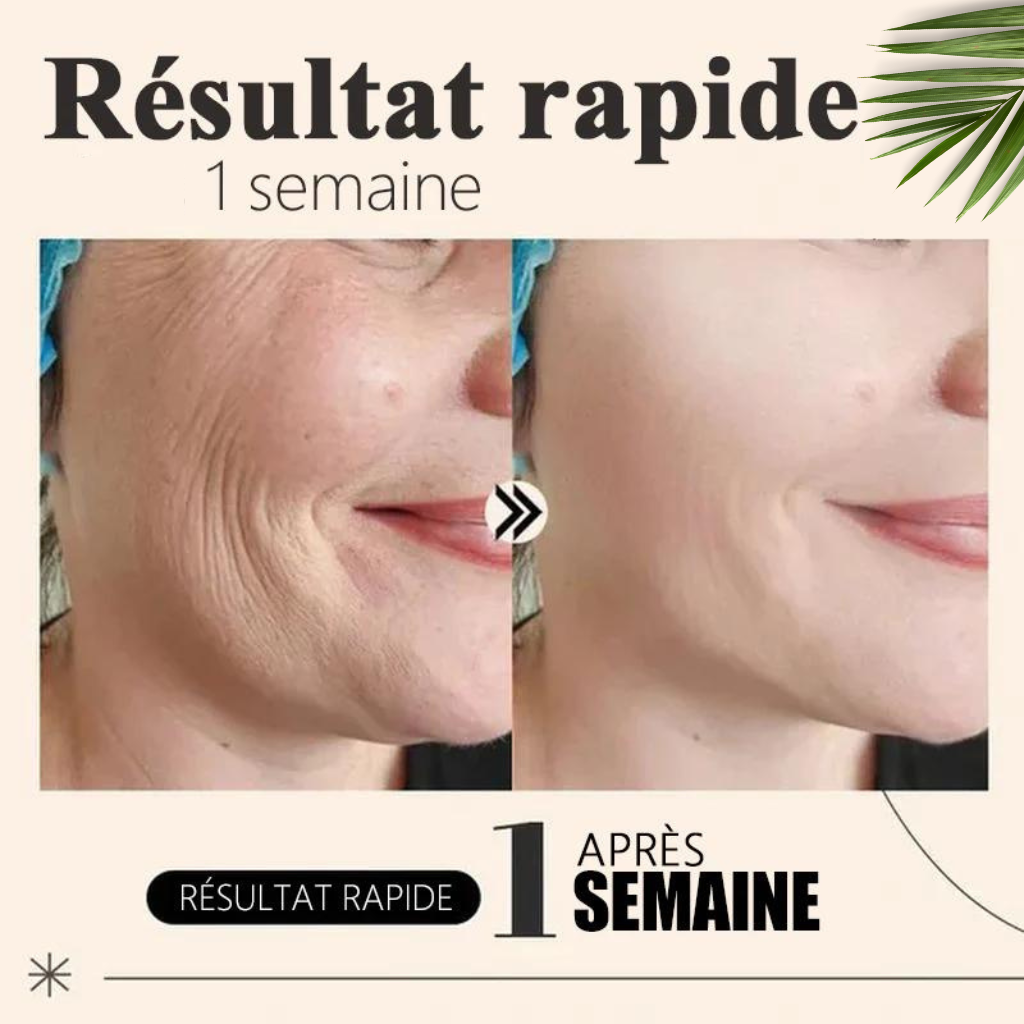 Pack Masque Collagène FontanaySkin™