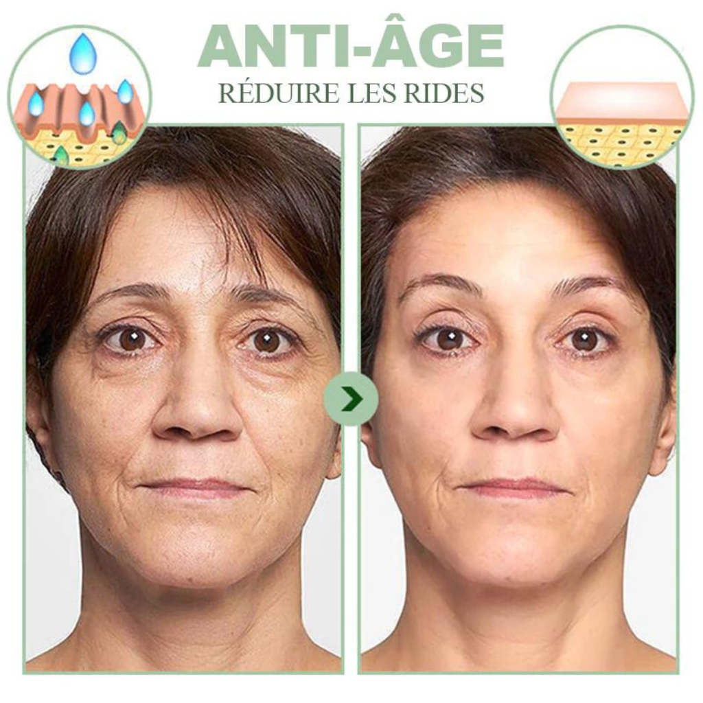 Pack Masque Collagène Fontanay™