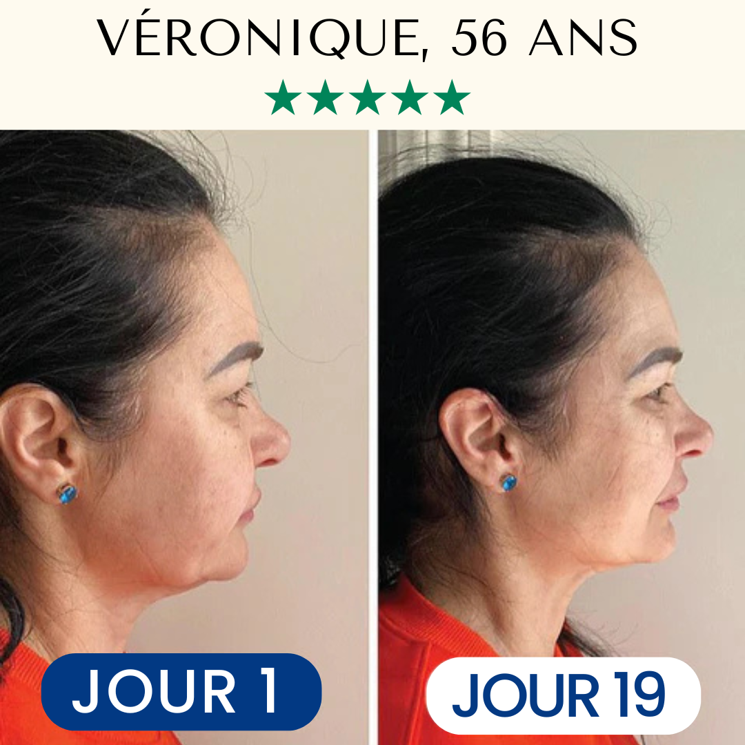 Masque Liftant Réutilisable FontanaySkin™