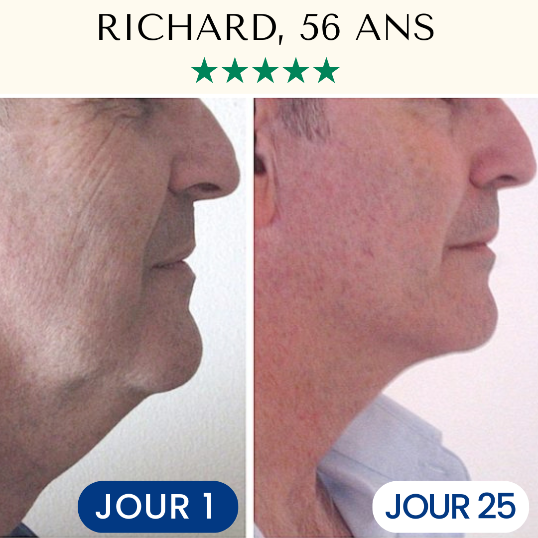 Masque Liftant Réutilisable FontanaySkin™