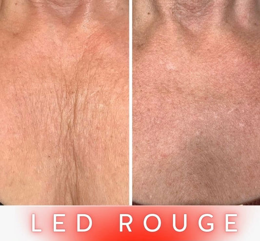 Masque LED Anti-Âge Pro - Cou et Décolleté