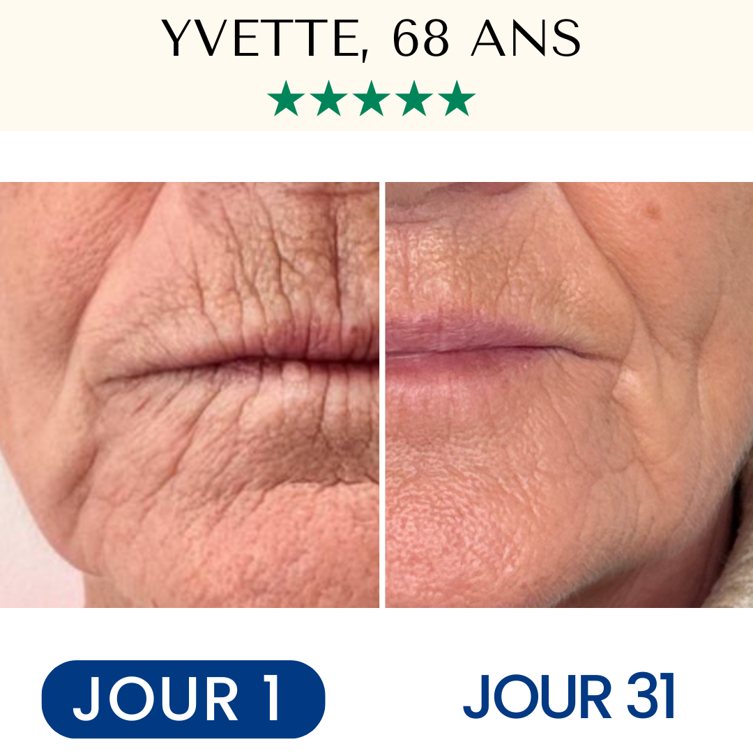 Masque Liftant Réutilisable FontanaySkin™