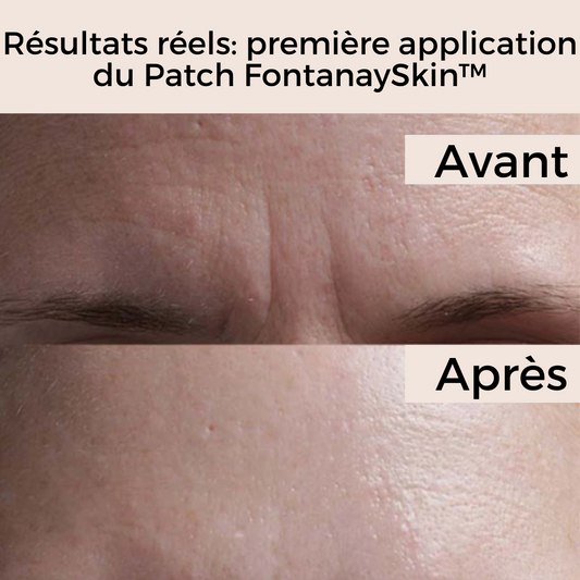 Patchs Visage Anti-Rides Réutilisables FontanaySkin™