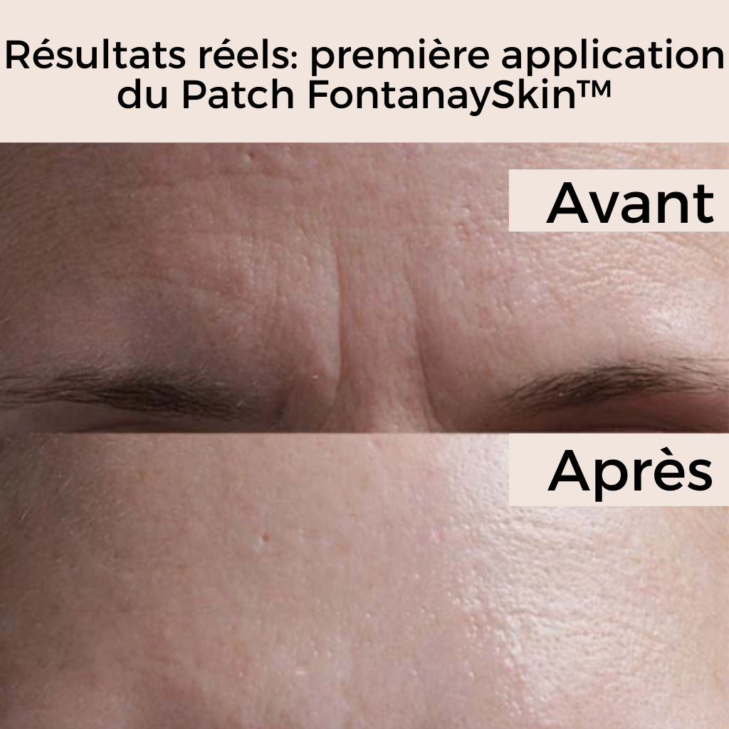 Pack Patchs Visage Anti-Rides Réutilisables FontanaySkin™
