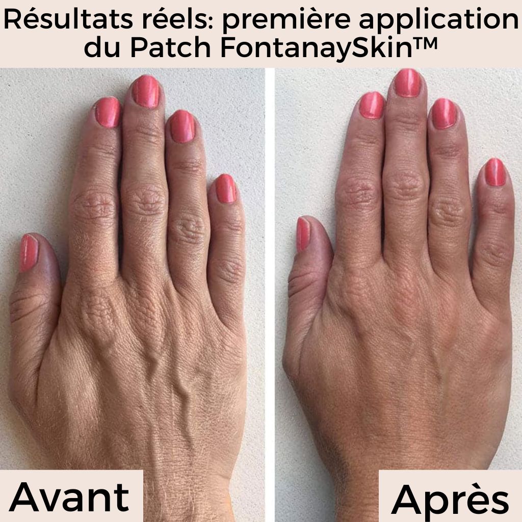 Patchs Mains Anti-Rides Réutilisables FontanaySkin™