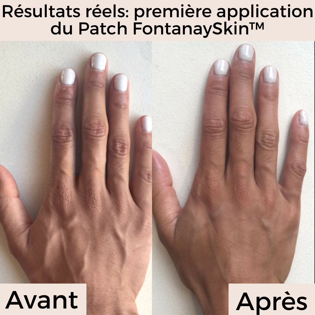 Patchs Mains Anti-Rides Réutilisables FontanaySkin™