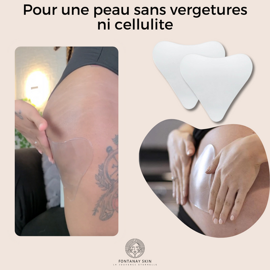 Patchs Corps Vergetures et Cellulite Réutilisables FontanaySkin™