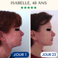 Masque Visage Fontanay™ Lift Raffermissant