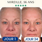 Masque Collagène FontanaySkin™