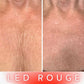 Masque LED Thérapie Pro - Cou et Décolleté