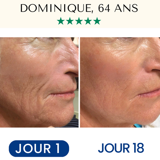 Masque Liftant Réutilisable FontanaySkin™