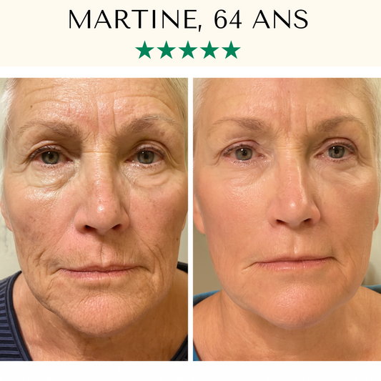 Masque LED Anti-Âge Pro - Visage