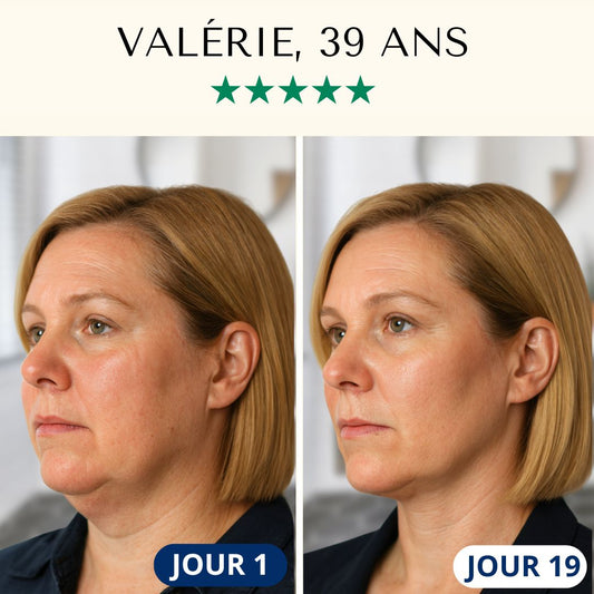 Masque Liftant Réutilisable FontanaySkin™